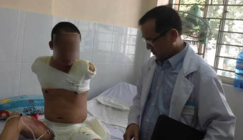 Cắt bỏ 2 tay khi kéo cây sắt trúng đường điện