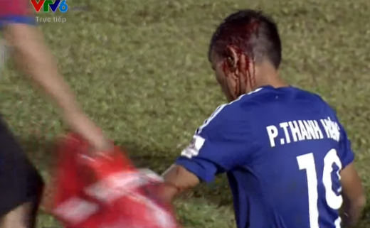 Cầu thủ Quảng Nam đầu bê bết máu, Văn Toàn bị từ chối penalty
