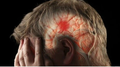 Dấu hiệu đột quỵ cực nguy hiểm ai cũng bỏ qua