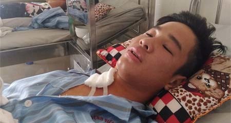 Vụ đạn lạc: 