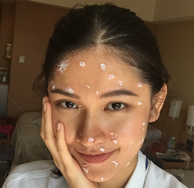 Thùy Dung bất ngờ đổ bệnh trước thềm chung kết Miss International