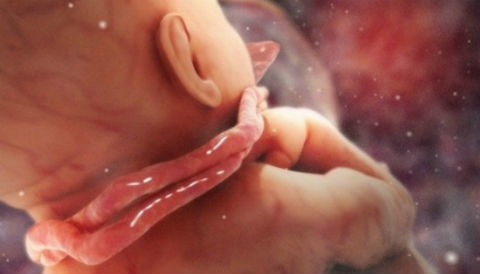 Phát hiện của nữ hộ sinh cứu thai nhi bị dây rốn quấn cổ 4 vòng