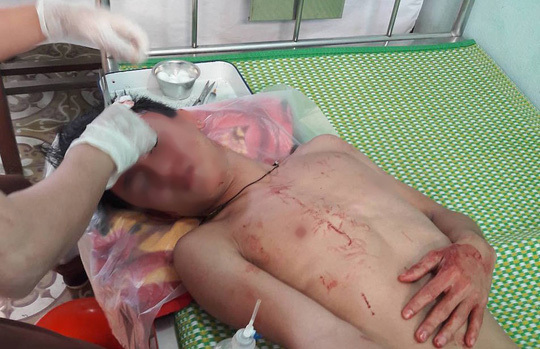 Côn đồ lao vào trường đánh thầy giáo và học sinh phải cấp cứu