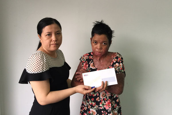 Chị H Tô Li Niê bị bỏng xăng cảm ơn bạn đọc