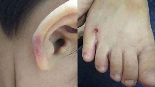 Cô giáo mầm non bị đình chỉ dạy vì đánh trẻ ở nhà