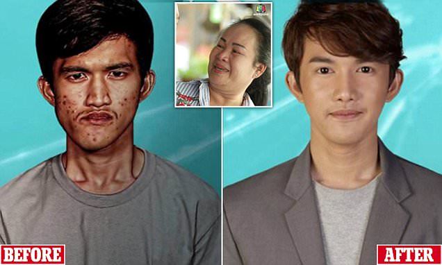 Mẹ bật khóc vì con quá đẹp sau 'đập đi xây lại'