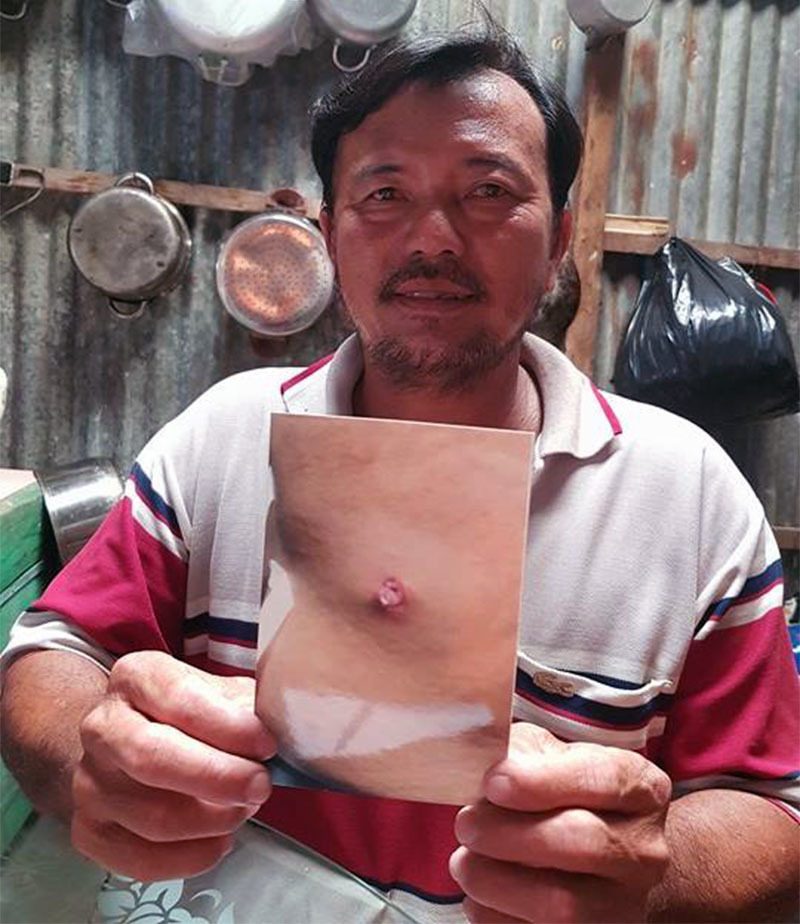 Xử lý cán bộ QLTT nổ súng khiến người dân bị thương