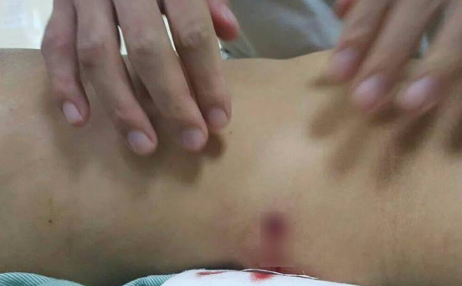 Hà Nội: Điều tra vụ đạn lạc khiến 2 cô gái bị thương