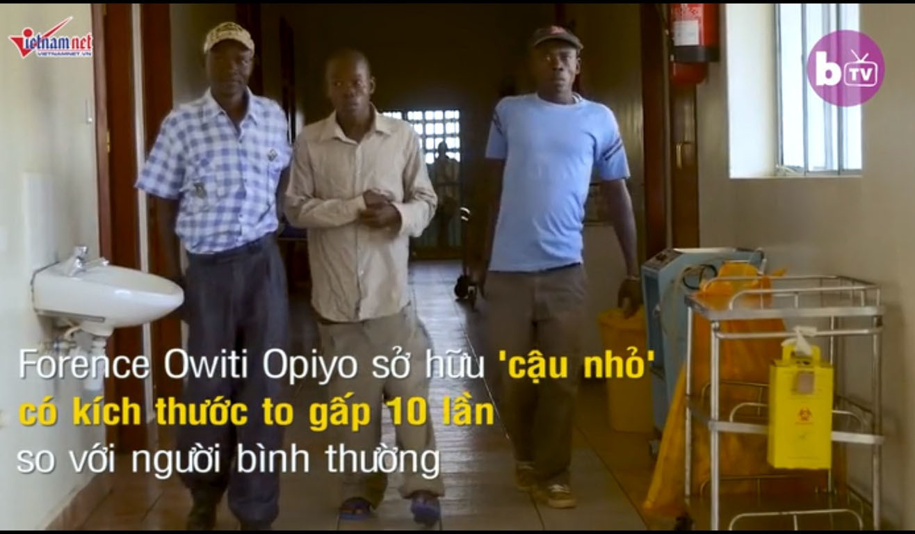 chàng trai có cậu nhỏ to nhất TG