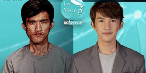 Mẹ bật khóc, không nhận ra con trai sau phẫu thuật thẩm mỹ