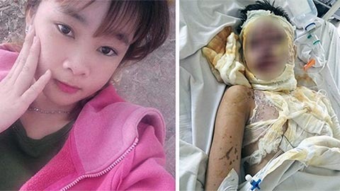 Gã trai nổi cuồng ghen, 2 thiếu nữ miền Tây bị tạt axit