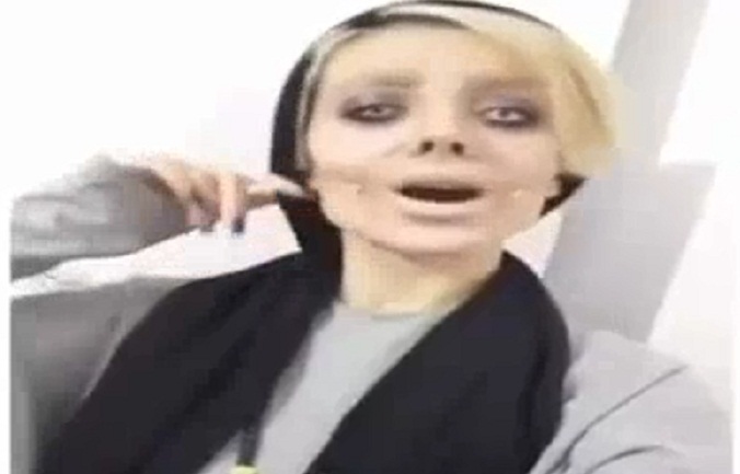 Khuôn mặt như phim kinh dị của thiếu nữ 50 lần phẫu thuật thẩm mỹ