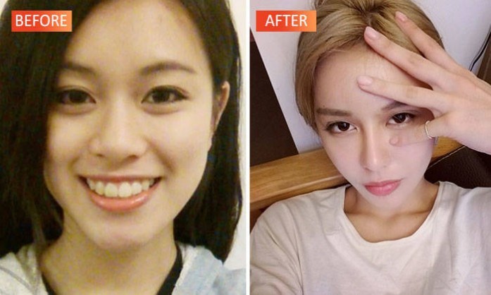 Phẫu thuật thẩm mỹ hàng chục lần để lấy lòng bạn trai