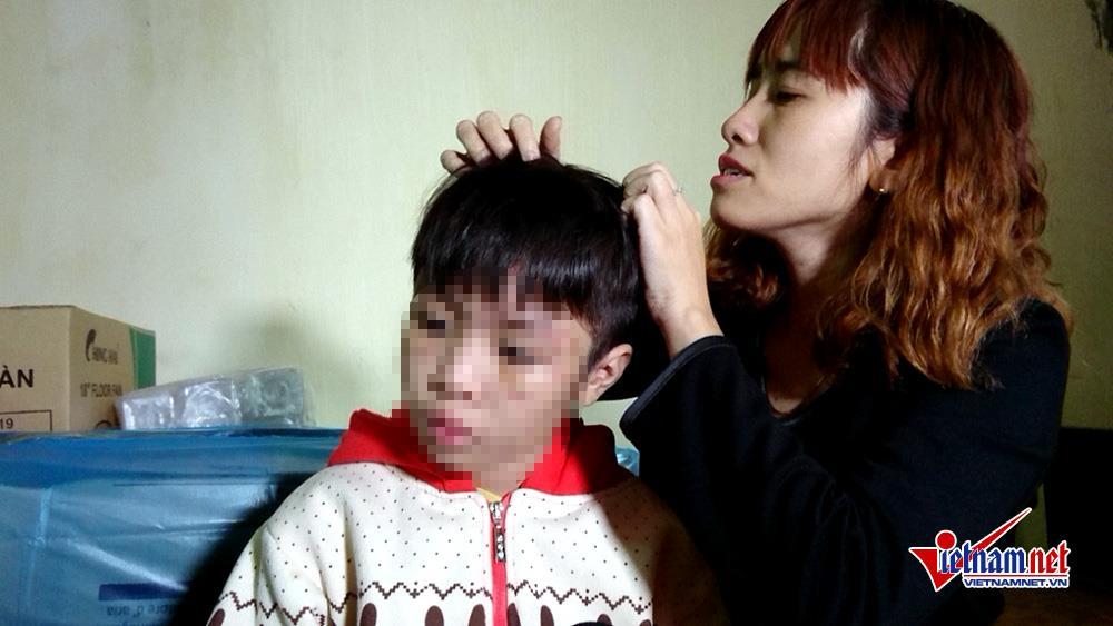 Bé trai bị bố và mẹ kế đánh rạn sọ não xin tha cho bố