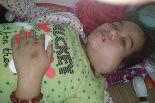 Ứa nước mắt vì câu nói của bé gái mắc bệnh ung thư