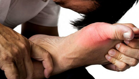 Người trẻ nên làm gì khi mắc bệnh gout?