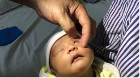 Cháu loét giác mạc khi bà vắt chanh vào mắt chữa ghèn