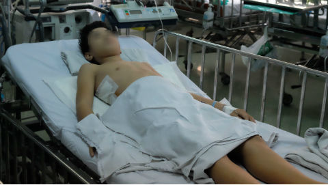 Ca mổ kép cứu bé trai bị khối u 1,5 kg chèn tim phổi, liệt chân