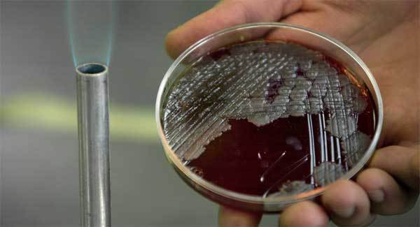 Phát hiện kháng thể bệnh than trong lính Triều Tiên đào tẩu