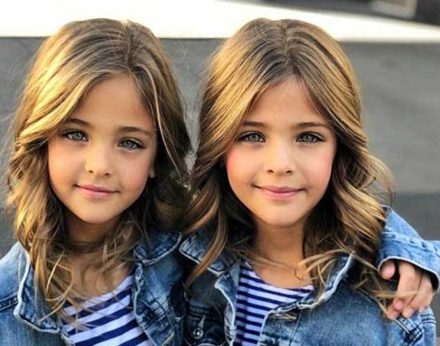 Ngắm cặp sinh đôi 'nhí' xinh nhất thế giới