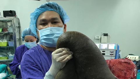 Chàng trai cõng mai rùa khổng lồ, 26 năm ngủ ngồi