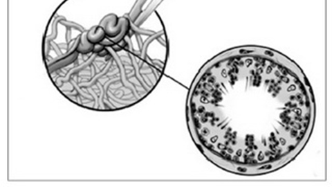 Kỹ thuật cứu tinh cho các cặp vợ chồng hiếm muộn