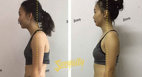 Bệnh công sở: Dấu hiệu nhỏ - Hiểm họa lớn