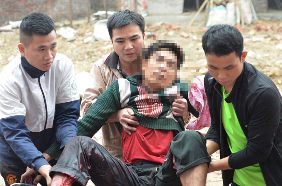 Nát tay vì nhặt đạn sau vụ nổ ở Bắc Ninh