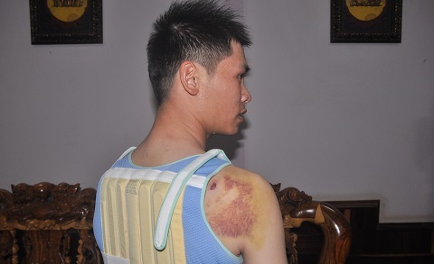 Bí thư xã mâu thuẫn ngoài xã hội, con trai đến bắn người nhập viện