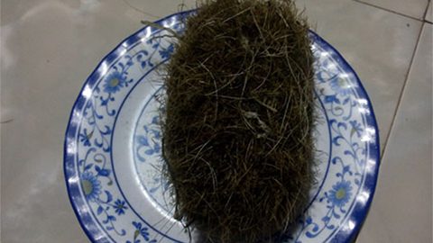 Mổ heo nái, tìm được vật lạ tiền tỷ