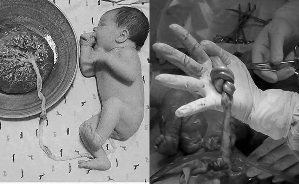 Khám thai định kỳ, nữ sinh Hà Nội sắp đẻ mà không biết