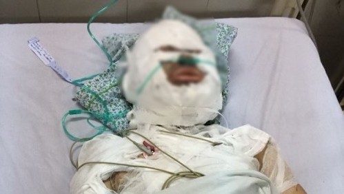 Hà Nội: Người đàn ông ngoại quốc tẩm xăng đốt bạn gái