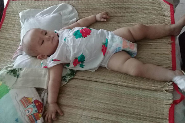 Ánh mắt mệt mỏi của bé gái 11 tháng tuổi ung thư máu