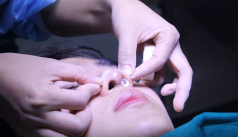 Trả giá đắt khi ham làm đẹp giá rẻ dịp tết